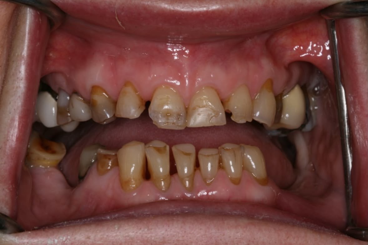 Before treatment result