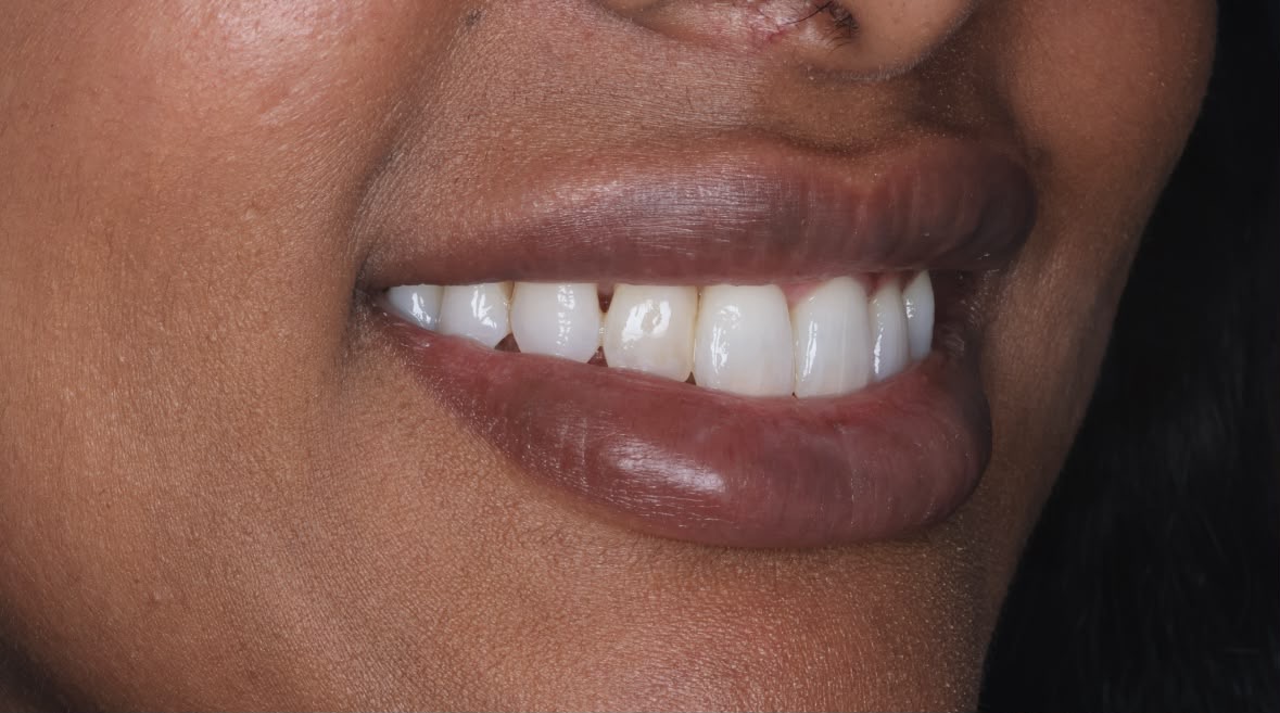 Before treatment result