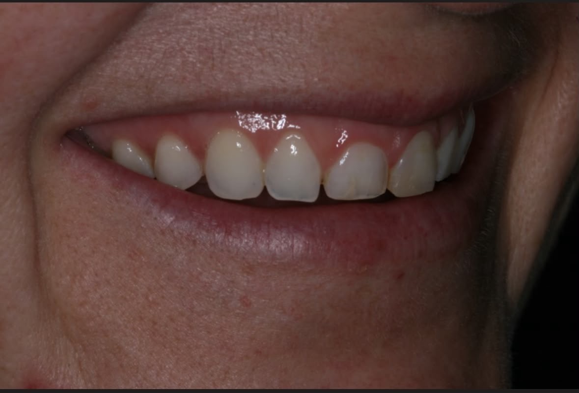 Before treatment result